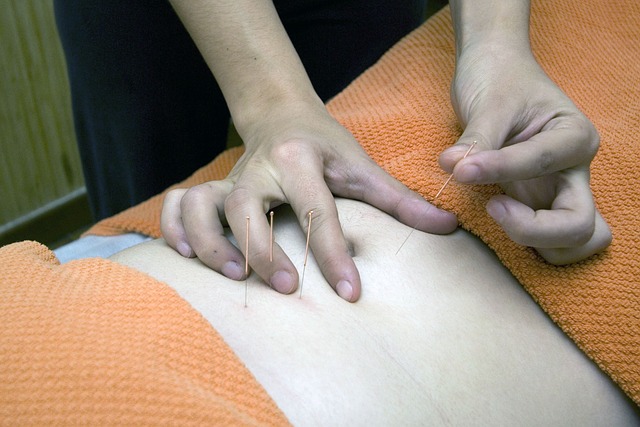 Can Acupuncture Support Pain Relief and Improve Your Overall Wellness Naturally?